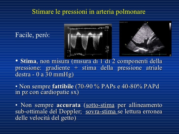 Imaging con Ecocardiogramma