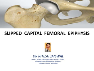 SLIPPED CAPITAL FEMORAL EPIPHYSIS
DR RITESH JAISWAL
M.B.B.S D.Ortho DNB (Ortho) M.N.A.M.S M.Ch (Ortho)
Fellowship in Joint Replacement ( Mumbai )
Fellow AO Trauma ( Switzerland )
 