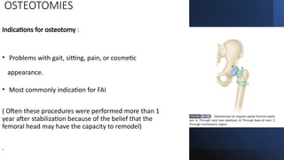 Presentation on topic Slipped capital femoral Epiphysispptx | PPTX