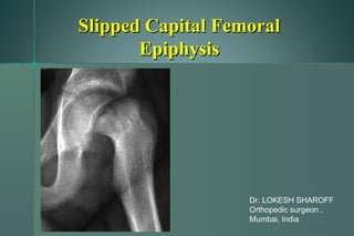 Slipped Capital FemoralSlipped Capital Femoral
EpiphysisEpiphysis
Dr. LOKESH SHAROFF
Orthopedic surgeon ,
Mumbai, India
 
