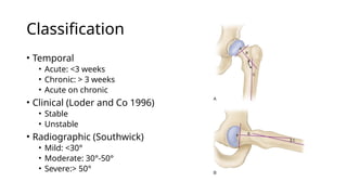 Comprehensive Overview of Pathology and Management of Slipped Capital ...