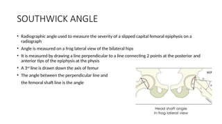 Slipped capital femoral epiphysis and management | PPTX