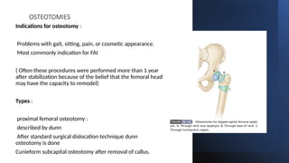 Slipped capital femoral epiphysis and management | PPTX