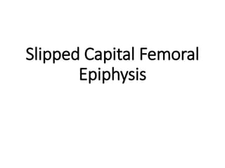 Slipped Capital Femoral
Epiphysis
 