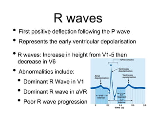 R waves
• First positive deflection following the P wave
• Represents the early ventricular depolarisation
• R waves: Increase in height from V1-5 then
decrease in V6
• Abnormalities include:
• Dominant R Wave in V1
• Dominant R wave in aVR
• Poor R wave progression
 