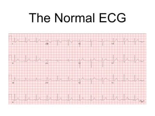 The Normal ECG
 