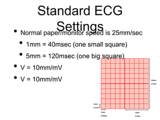 Standard ECG
Settings• Normal paper/monitor speed is 25mm/sec
• 1mm = 40msec (one small square)
• 5mm = 120msec (one big square)
• V = 10mm/mV
• V = 10mm/mV
 