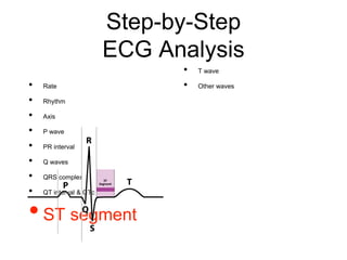 Step-by-Step
ECG Analysis
• Rate
• Rhythm
• Axis
• P wave
• PR interval
• Q waves
• QRS complex
• QT interval & QTc
•ST segment
• T wave
• Other waves
 