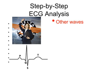 Step-by-Step
ECG Analysis
• Rate
• Rhythm
• Axis
• P wave
• PR interval
• Q waves
• QRS complex
• QT interval & QTc
• ST segment
• T wave
•Other waves
 