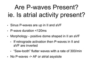 Are P-waves Present?
ie. Is atrial activity present?
• Sinus P-waves are up in II and aVF
• P-wave duration <120ms
• Morphology - positive dome shaped in II an aVF
• If retrograde activation then P-waves in II and
aVF are inverted
• “Saw-tooth” flutter waves with a rate of 300/min
• No P-waves -> AF or atrial asystole
 