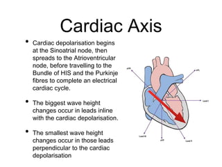 Cardiac Axis
• Cardiac depolarisation begins
at the Sinoatrial node, then
spreads to the Atrioventricular
node, before travelling to the
Bundle of HIS and the Purkinje
fibres to complete an electrical
cardiac cycle.
• The biggest wave height
changes occur in leads inline
with the cardiac depolarisation.
• The smallest wave height
changes occur in those leads
perpendicular to the cardiac
depolarisation
 
