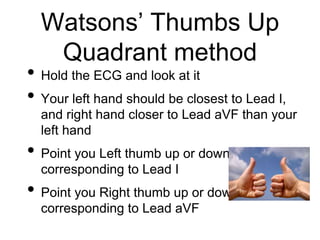 Watsons’ Thumbs Up
Quadrant method
• Hold the ECG and look at it
• Your left hand should be closest to Lead I,
and right hand closer to Lead aVF than your
left hand
• Point you Left thumb up or down
corresponding to Lead I
• Point you Right thumb up or down
corresponding to Lead aVF
 