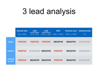 3 lead analysis
 