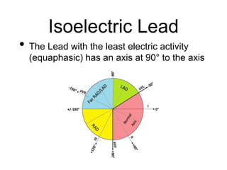 Isoelectric Lead
• The Lead with the least electric activity
(equaphasic) has an axis at 90° to the axis
 