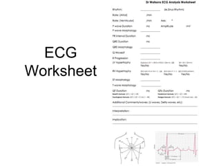 ECG
Worksheet
 