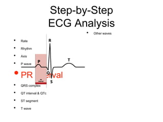 Step-by-Step
ECG Analysis
• Rate
• Rhythm
• Axis
• P wave
•PR interval
• QRS complex
• QT interval & QTc
• ST segment
• T wave
• Other waves
 