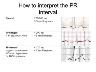 How to interpret the PR
interval
 