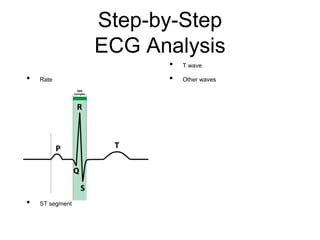 Step-by-Step
ECG Analysis
• Rate
• Rhythm
• Axis
• P wave
• PR interval
• Q waves
•QRS complex
• QT interval & QTc
• ST segment
• T wave
• Other waves
 