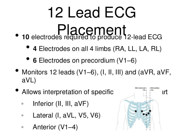 ECG Analysis