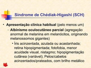 Síndrome de Chédiak-Higashi (SCH)
• Apresentação clínica habitual (pelo menos um)
– Albinismo oculocutâneo parcial (agregação
anormal de melanina em melanócitos, originando
melanossomos gigantes)
• Íris acinzentada, azulada ou acastanhada;
retina hipopigmentada; fotofobia, menor
acuidade visual, nistagmo; hipopigmentação
cutânea (variável); Pelos/cabelos
acinzentados/prateados, com brilho metálico

 
