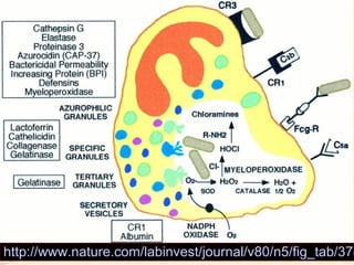Síndrome de Chédiak-Higashi (SCH)

http://www.nature.com/labinvest/journal/v80/n5/fig_tab/378

 