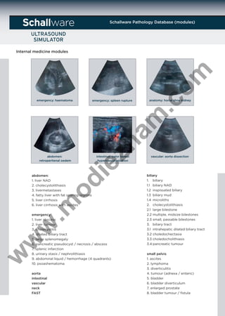 Schallware Pathology Database (modules)

ware

emergency: haematoma

anatomy: horse shoe kidney

zh

am

emergency: spleen rupture

.c
om

Internal medicine modules

intestinal: color bowel
hypervascularisation

ie

abdomen:
retroperitenal oedem

.m

od

abdomen:
1. liver NAD
2. cholecystolithiasis
3. livermetastases
4. fatty liver with fat sparing regions
5. liver cirrhosis
6. liver cirrhosis with ascites

w

w

w

emergency
1. liver abscess
2. liver tumour
3. cholecystitis
4. dilated biliary tract
5. large splenomegaly
6. pancreatic pseudocyst / necrosis / abscess
7. splenic infarction
8. urinary stasis / nephrolithiasis
9. abdominal liquid / hemorrhage (4 quadrants)
10. psoashematoma

aorta
intestinal
vascular
neck
FAST

vascular: aorta dissection

biliary
1. biliary
1.1 biliary NAD
1.2 inspissated biliary
1.3 biliary mud
1.4 microliths
2. cholecystolithiasis
2.1 large bilestone
2.2 multiple, midsize bilestones
2.3 small, passable bilestones
3. biliary tract
3.1 intrahepatic dilated biliary tract
3.2 choledochectasia
3.3 choledocholithiasis
3.4 pancreatic tumour
small pelvis
1. ascites
2. lymphoma
3. diverticulitis
4. tumour (adnexa / enteric)
5. bladder
6. bladder diverticulum
7. enlarged prostate
8. bladder tumour / ﬁstula

 