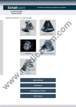 Schallware Pathology Database (modules)

ware

.c
om

obstetrics trimenon I, II, III, gyn modules

vaginal

obstetrics 2 reconstructed

.m

od

ie

obstetrics 2

zh

am

vaginal reconstructed

w

w

w

obstetrics 1

gynecology
obstetrics
emergency / pelvis
fetal heart

 
