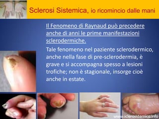Sclerosi Sistemica, io ricomincio dalle maniIl Fenomeno di Raynaud può precedere anche di anni le prime manifestazioni sclerodermiche. 	Tale fenomeno nel paziente sclerodermico, anche nella fase di pre-sclerodermia, è grave e si accompagna spesso a lesioni trofiche; non è stagionale, insorge cioè anche in estate.www.sclerosistemica.info