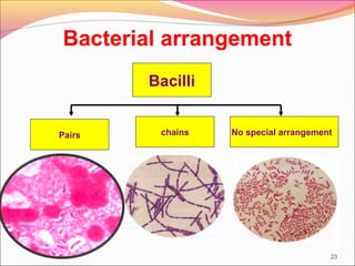 Bacterial arrangement
Bacilli

Pairs

chains

No special arrangement

23

 