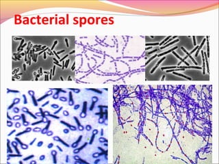 Bacterial spores

 