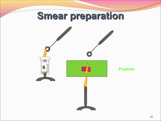 Smear preparation

S

Fixation

30

 