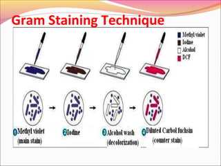 Gram Staining Technique

 
