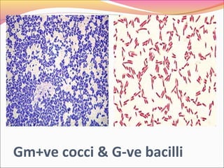 Gm+ve cocci & G-ve bacilli

 
