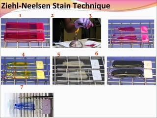 Ziehl-Neelsen Stain Technique
1

2

4

7

3

5

6

 