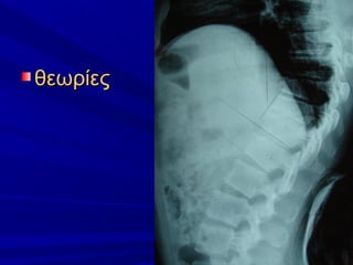 θεωρίεςθεωρίες
 