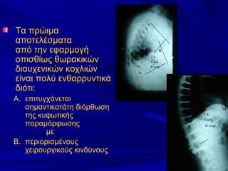 Τα πρώιμαΤα πρώιμα
αποτελέσματααποτελέσματα
από την εφαρμογήαπό την εφαρμογή
οπισθίως θωρακικώνοπισθίως θωρακικών
διαυχενικών κοχλιώνδιαυχενικών κοχλιών
είναι πολύ ενθαρρυντικάείναι πολύ ενθαρρυντικά
διότι:διότι:
A.A. επιτυγχάνεταιεπιτυγχάνεται
σημαντικοτάτη διόρθωσησημαντικοτάτη διόρθωση
της κυφωτικήςτης κυφωτικής
παραμόρφωσηςπαραμόρφωσης
μεμε
B.B. περιορισμένουςπεριορισμένους
χειρουργικούς κινδύνουςχειρουργικούς κινδύνους
 