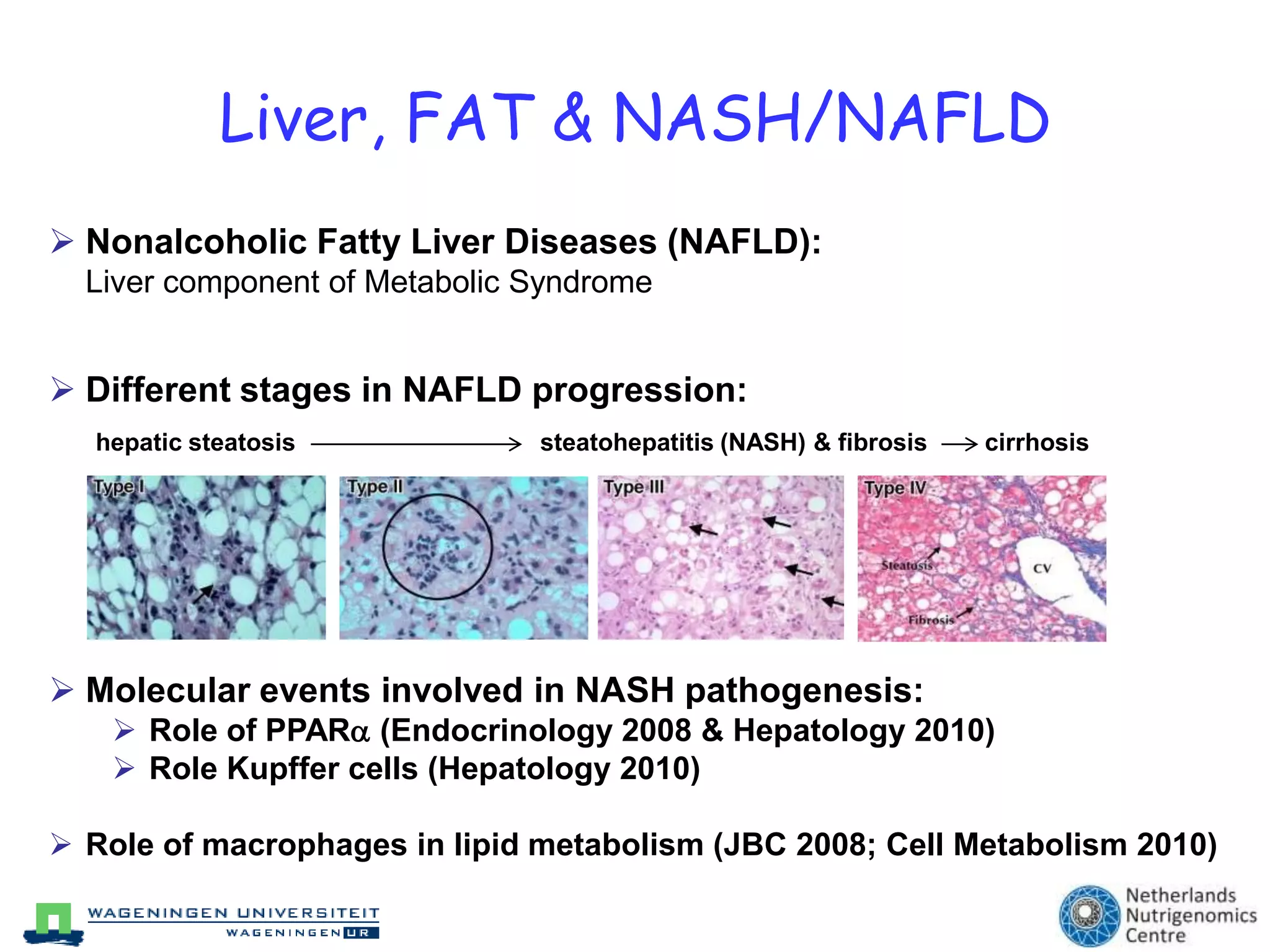 Liver, FAT & NASH/NAFLDNonalcoholic Fatty Liver Diseases (NAFLD):Liver component of Metabolic Syndrome