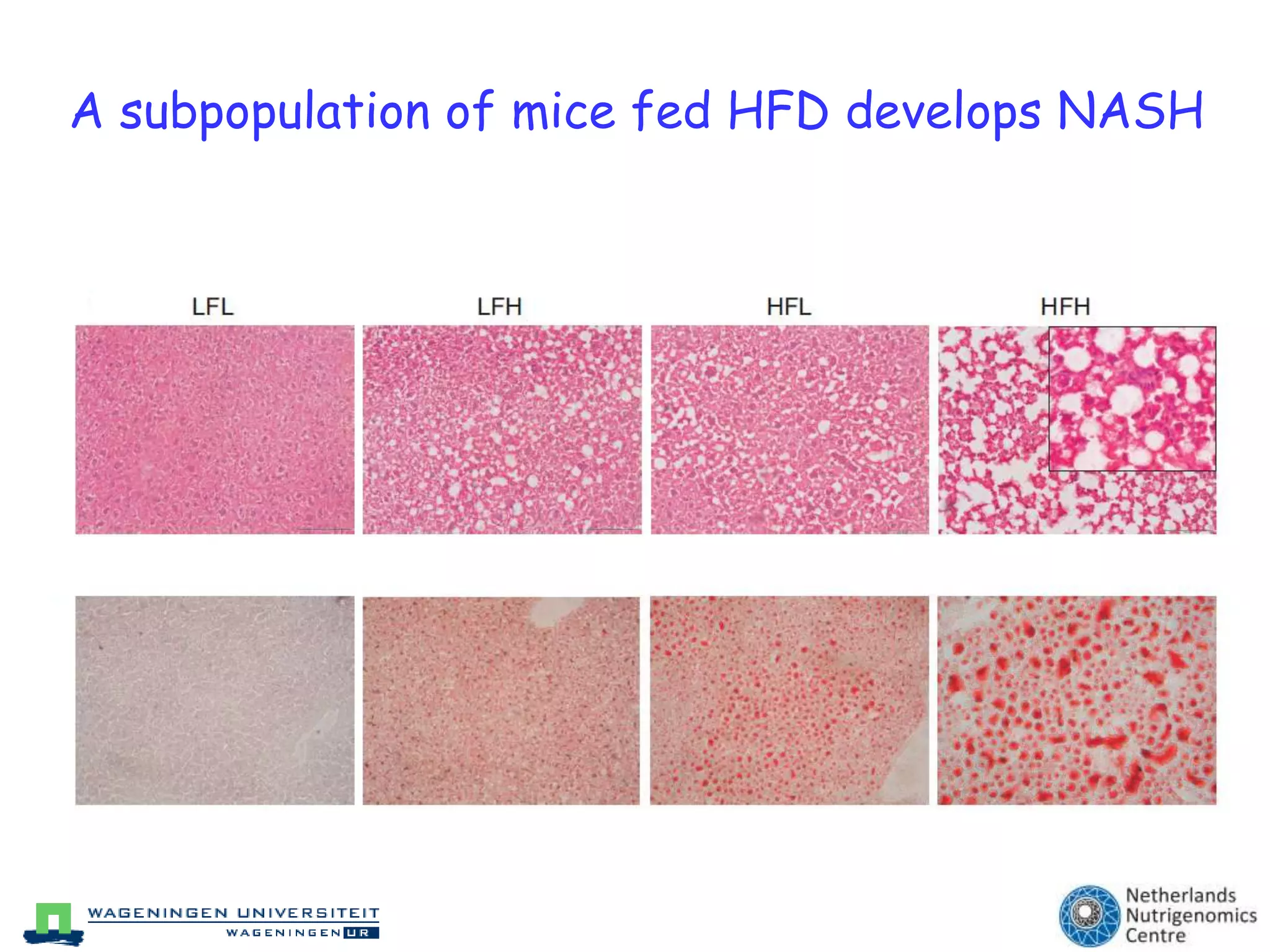 Role Kupffer cells (Hepatology 2010) 