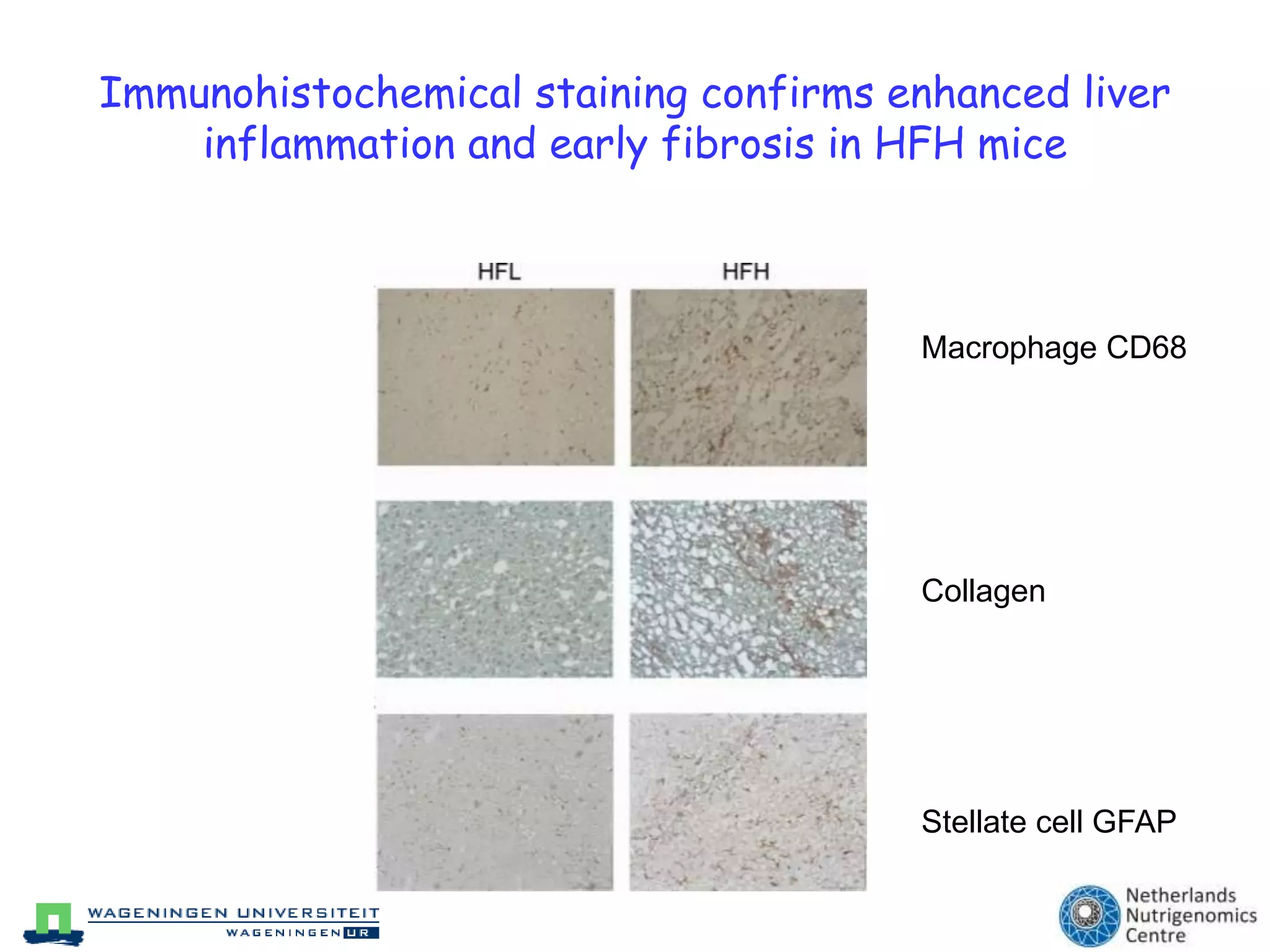 Role of macrophages in lipid metabolism (JBC 2008; Cell Metabolism 2010)hepatic steatosis 		              steatohepatitis (NASH) & fibrosiscirrhosis