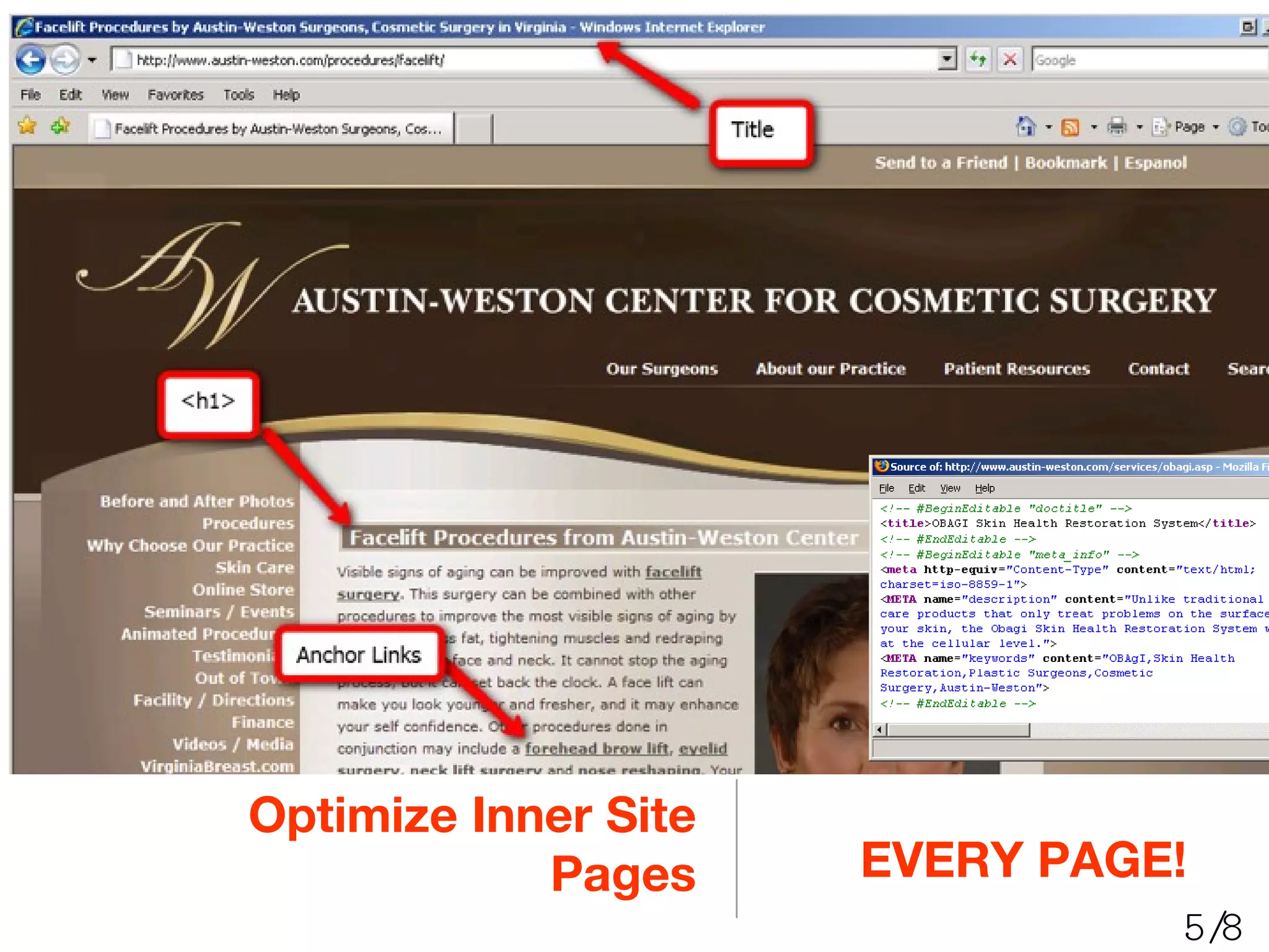 Optimize Inner Site Pages EVERY PAGE! 5/8 