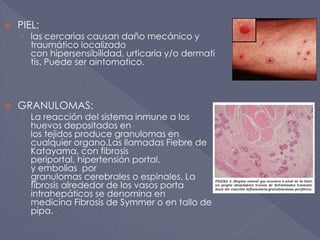  PIEL:
› las cercarias causan daño mecánico y
traumático localizado
con hipersensibilidad, urticaria y/o dermati
tis. Puede ser aintomatico.
 GRANULOMAS:
› La reacción del sistema inmune a los
huevos depositados en
los tejidos produce granulomas en
cualquier organo.Las llamadas Fiebre de
Katayama, con fibrosis
periportal, hipertensión portal,
y embolias por
granulomas cerebrales o espinales. La
fibrosis alrededor de los vasos porta
intrahepáticos se denomina en
medicina Fibrosis de Symmer o en tallo de
pipa.
 