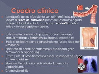  La mayoría de las infecciones son asintomáticas, pero no
todas: la fiebre de Katayama por esquistosomiasis aguda
incluye dolor abdominal, tos, diarrea, eosinofilia, fiebre,
fatiga y hepatoesplenomegalia.
 La infección continuada puede causar reacciones
granulomatosas y fibrosis en los órganos afectados:
 Pólipos cólicos y diarrea sanguinolenta (sobre todo por
S.mansoni).
 Hipertensión portal, hematemesis y esplenomegalia
(S.mansoni, S.japonicum).
 Cistitis y uretritis con hematuria e incluso cáncer de vejiga
(S.haematobium).
 Hipertensión pulmonar (sobre todo S.mansoni y
S.japonicum).
 Glomerulonefritis.
 