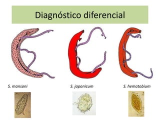 Diagnóstico diferencial




S. mansoni            S. japonicum   S. hematobium
 