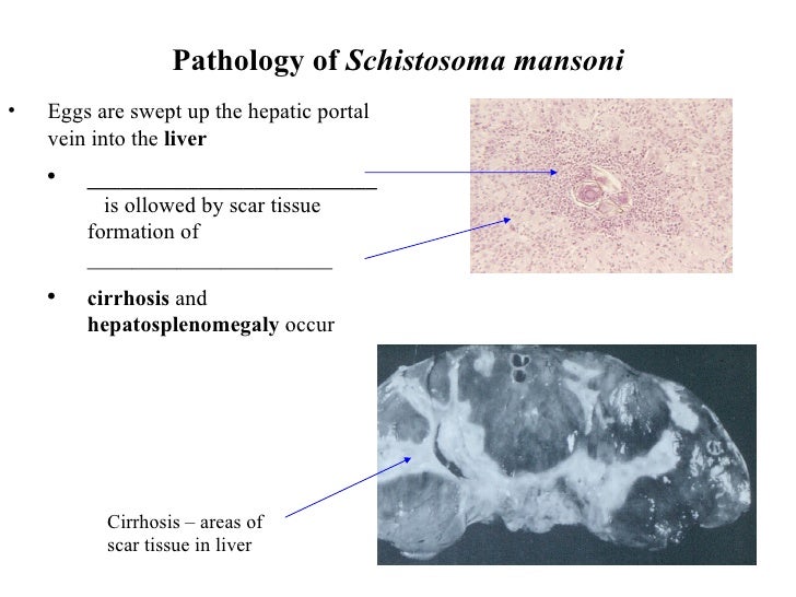 Schistosomes