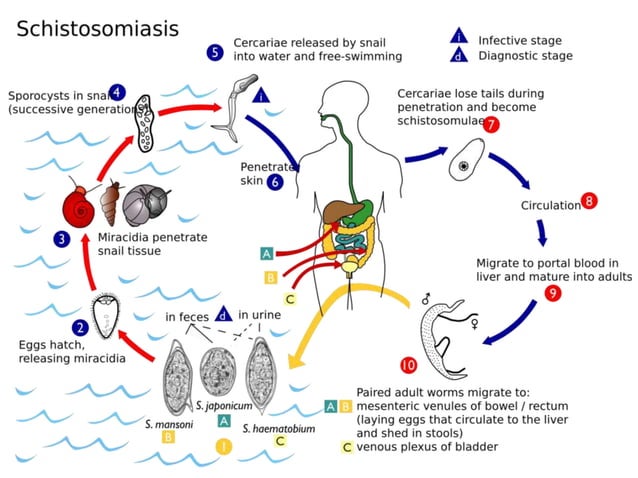 Schistosomiasis