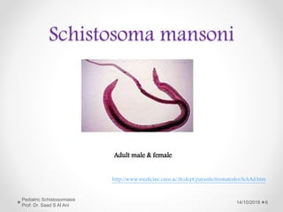 Schistosoma mansoni
Adult male & female
http://www.medicine.cmu.ac.th/dept/parasite/trematodes/SchAd.htm
14/10/2018
Pediatric Schistosomiasis
Prof. Dr. Saad S Al Ani
6
 