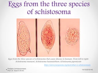 Eggs from the three species
of schistosoma
Eggs from the three species of schistosoma that cause disease in humans. From left to right:
Schistosoma mansoni, Schistosoma haematobium, Schistosoma japonicum
https://www.yourgenome.org/facts/what-is-schistosomiasis
14/10/2018
Pediatric Schistosomiasis
Prof. Dr. Saad S Al Ani
9
 