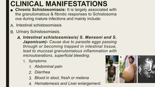 CLINICAL MANIFESTATIONS
■ Chronic Schistosomiasis: It is largely associated with
the granulomatous & fibrotic responses to Schistosoma
ova during mature infections and mainly include:
A. Intestinal schistosomiasis
B. Urinary Schistosomiasis.
A. Intestinal schistosomiasis( S. Mansoni and S.
Japonicum)- Cause due to parasite eggs passing
through or becoming trapped in intestinal tissue,
lead to mucosal granulomatous inflammation with
microulcerations, superficial bleeding.
1. Symptoms:
1. Abdominal pain
2. Diarrhea
3. Blood in stool, fresh or melena
4. Hematemesis and Liver enlargement.
 