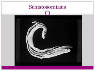 Schistosomiasis
 