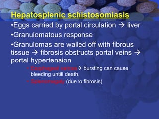 Hepatosplenic schistosomiasis
•Eggs carried by portal circulation  liver
•Granulomatous response
•Granulomas are walled off with fibrous
tissue  fibrosis obstructs portal veins 
portal hypertension
• Esophageal varices bursting can cause
bleeding untill death.
• Splenomegaly (due to fibrosis)
 